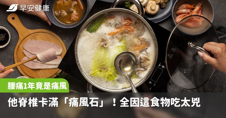 痛風不只痛關節！他腰痛一年才知脊椎卡滿「痛風石」全因這食物吃太兇