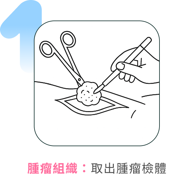 腫瘤組織:取出腫瘤檢體