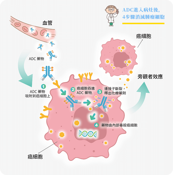 ADC進入病灶後,4步驟消滅腫瘤細胞